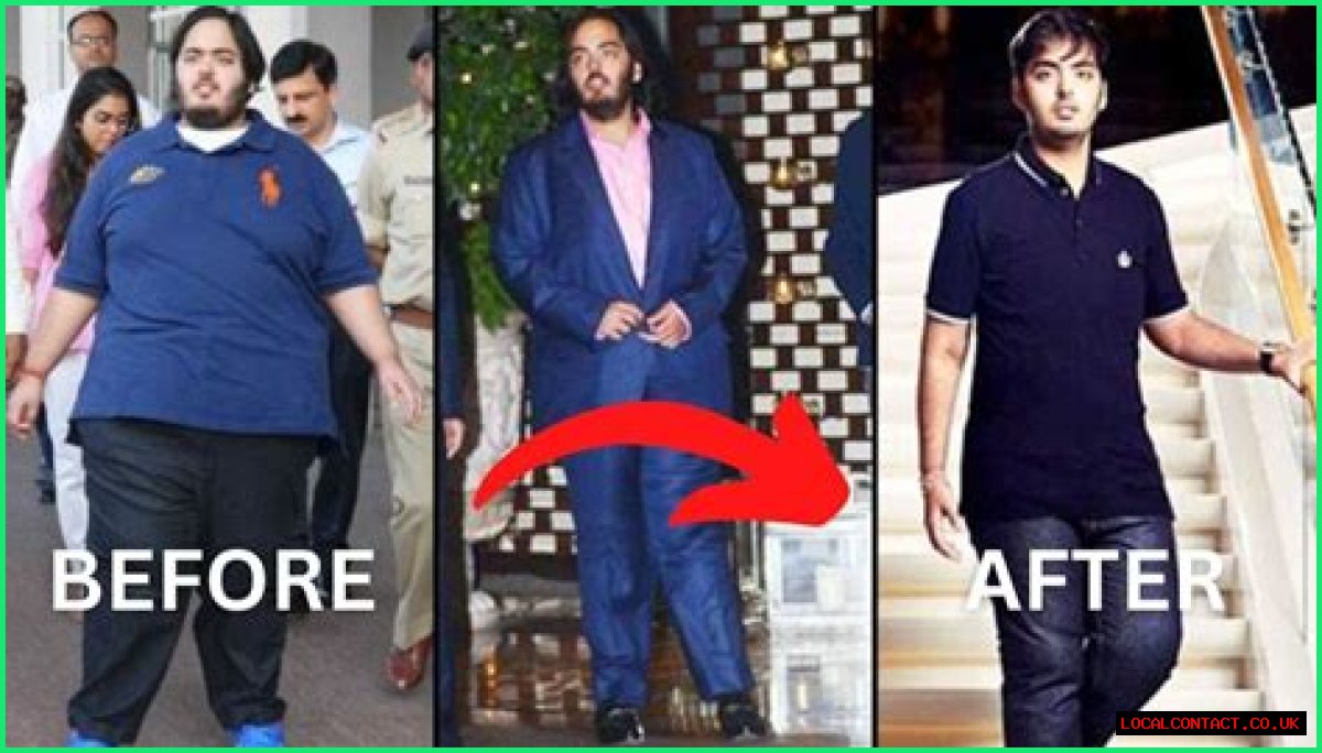 Anant Ambani's Health Journey: Is His Disease Curable Or Not?