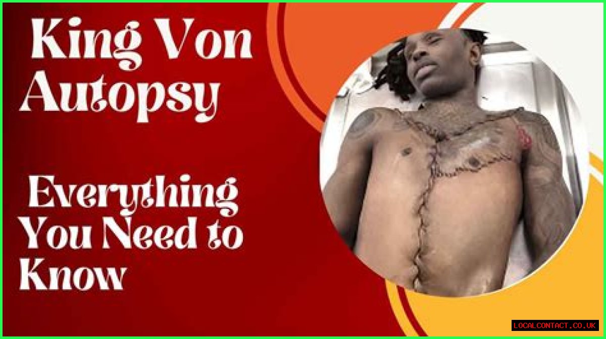 Autopsy Details On King Von's Demise: Uncovering The Tragic Truth