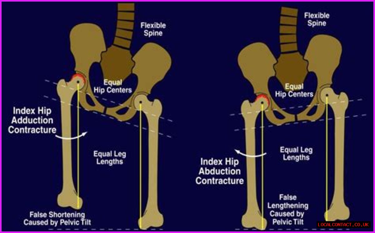 How Leg Positions Effect Height in Photos