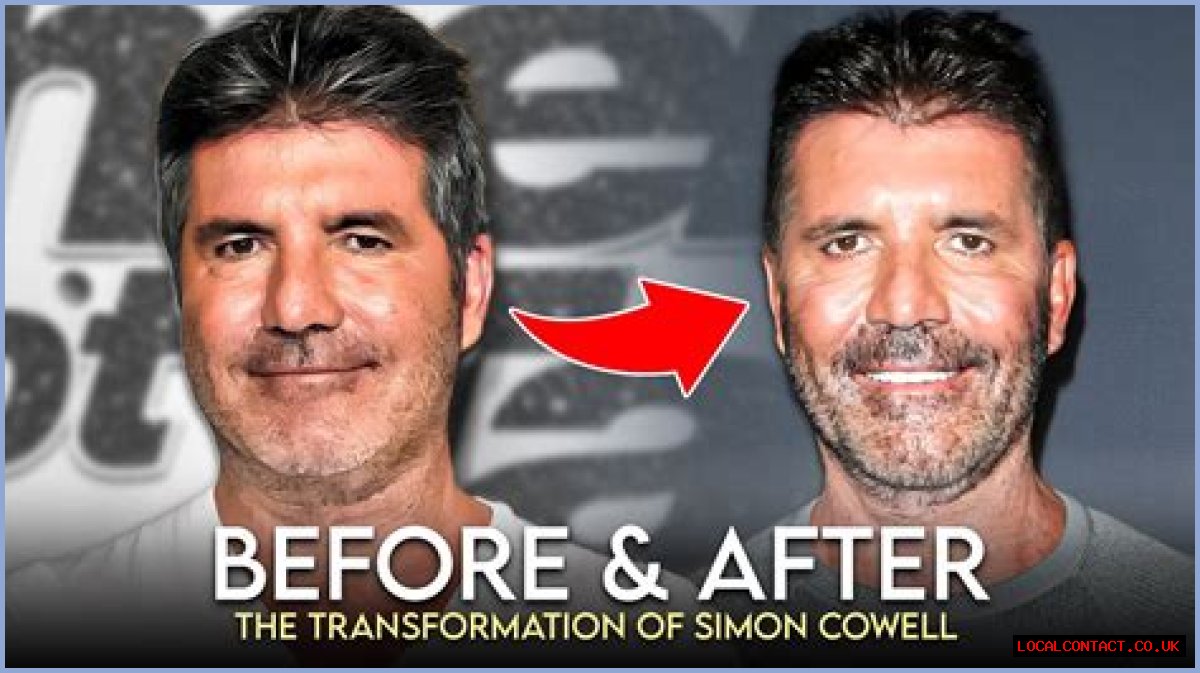Is Simon Cowell Sick? An In-Depth Look At His Health And Well-Being