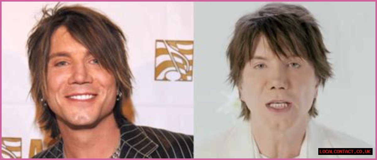 John Rzeznik Facelift | Goo Goo Dolls Frontman Plastic Surgery Before And After