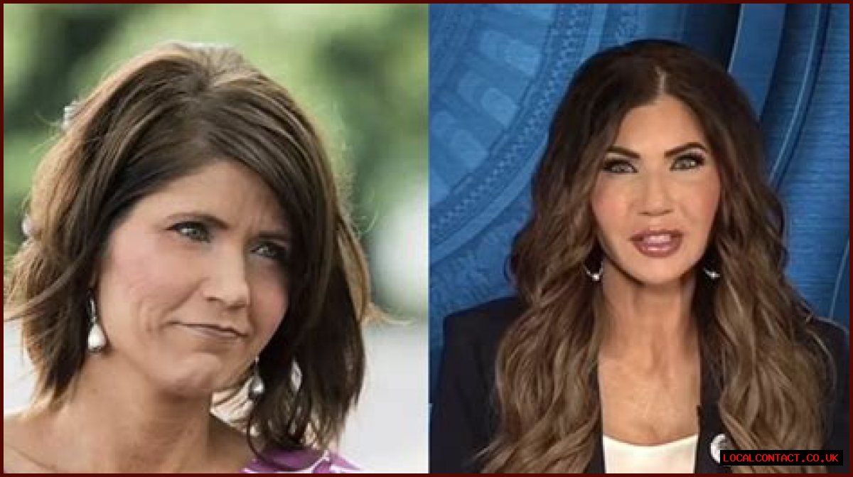 Kristi Noem Before And After: A Comprehensive Look At Her Transformation