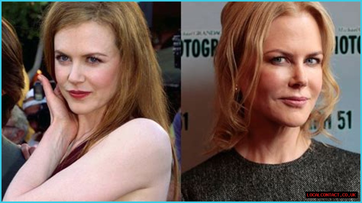 Nicole Kidman Plastic Surgery: Unveiling The Truth Behind The Transformation