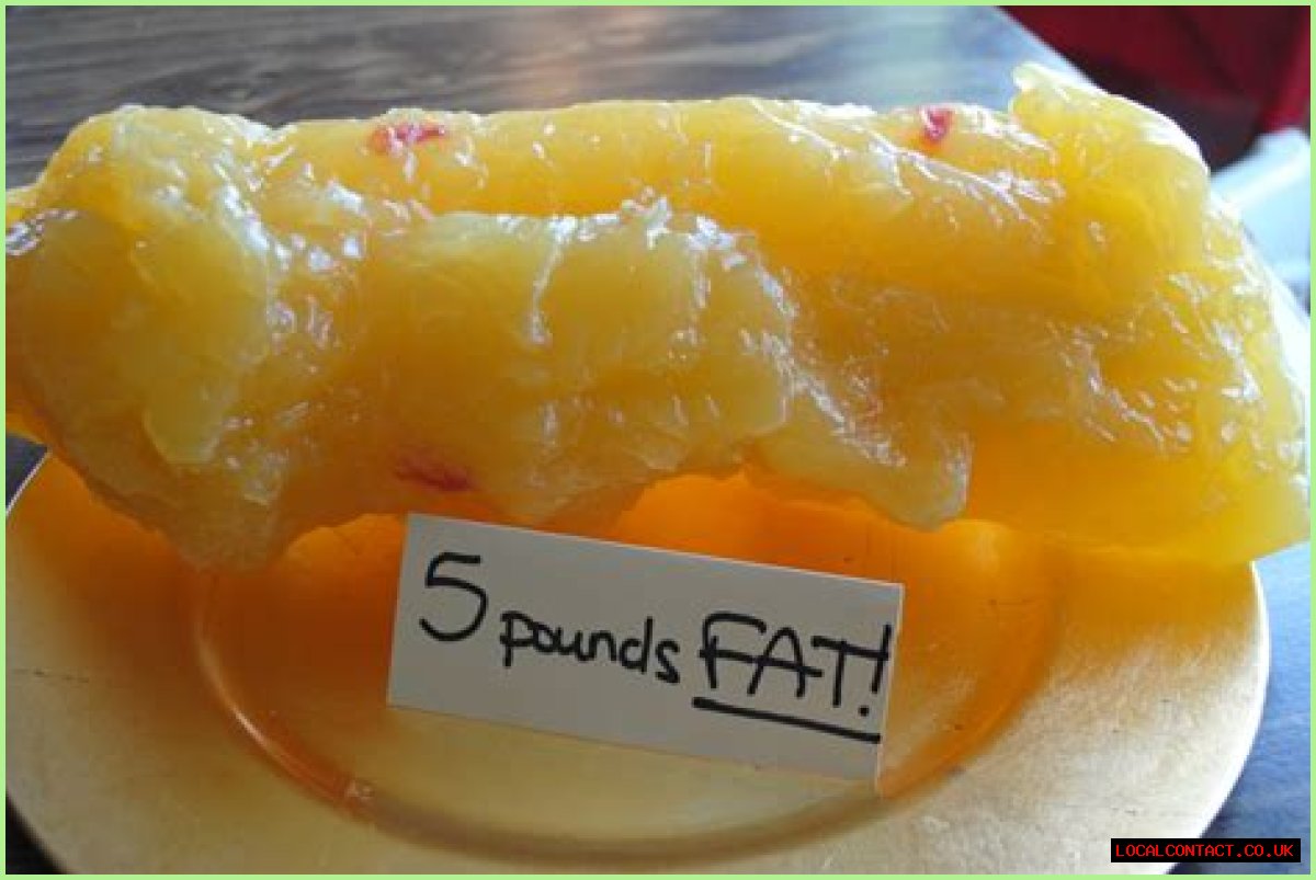 Visualizing 30 Pounds Of Fat: Unveiling The Health Implications